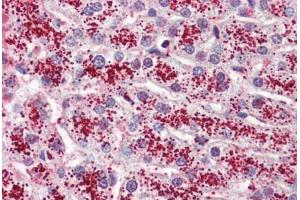 Anti-GPR119 antibody  ABIN1048698 IHC staining of human liver.