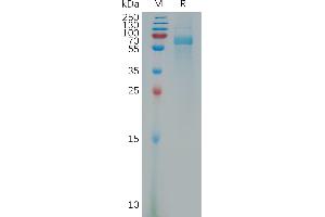 Human Protein, His Tag on SDS-PAGE under reducing condition.