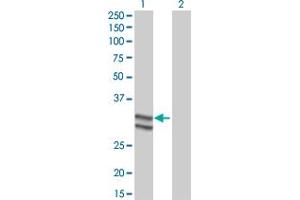 Western Blot analysis of SERPINC1 expression in transfected 293T cell line by SERPINC1 monoclonal antibody (M02), clone 2B12. (SERPINC1 抗体  (AA 1-259))