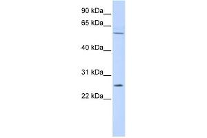 WB Suggested Anti-FAM124A Antibody Titration: 0. (FAM124A 抗体  (Middle Region))