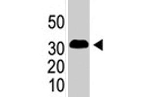 The SNAI1 polyclonal antibody  is used in Western blot to detect SNAI1 in SNAI1-293 cells (flag-tagged) . (SNAIL 抗体  (AA 9-39))