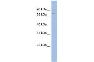 MTMR12 antibody used at 1 ug/ml to detect target protein. (MTMR12 抗体  (Middle Region))