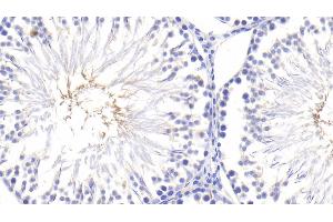 Detection of TNFa in Rat Testis Tissue using Polyclonal Antibody to Tumor Necrosis Factor Alpha (TNFa) (TNF alpha 抗体  (AA 80-235))