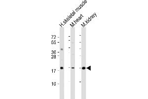 All lanes : Anti-SDHC Antibody (C-Term) at 1:2000 dilution Lane 1: human skeletal muscle lysate Lane 2: mouse heart lysate Lane 3: mouse kidney lysate Lysates/proteins at 20 μg per lane. (SDHC 抗体  (AA 113-144))