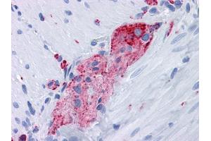 Immunohistochemical analysis of paraffin-embedded human Small Intestine, myenteric plexus tissues using anti-SYP mouse mAb (Synaptophysin 抗体)