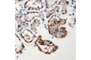 Immunohistochemical analysis of Factor XII HC staining in human kidney formalin fixed paraffin embedded tissue section. (F12 抗体  (Heavy Chain, N-Term))