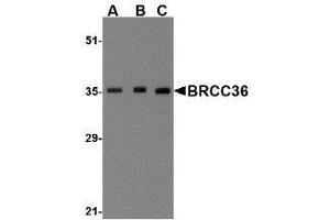 Western blot analysis of BRCC36 in MCF7 cell lysate with AP30164PU-N BRCC36 antibody at (A) 0. (BRCC3 抗体  (N-Term))
