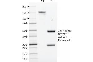 SDS-PAGE (SDS) image for anti-SRY (Sex Determining Region Y)-Box 2 (SOX2) (AA 176-305) antibody (ABIN6940611)