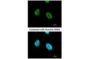 ICC/IF Image Immunofluorescence analysis of paraformaldehyde-fixed HeLa, using ATF7, antibody at 1:500 dilution. (AFT7 抗体  (C-Term))