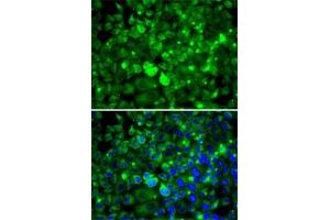 Immunofluorescence analysis of MCF7 cells using RPLP1 antibody (ABIN6129657, ABIN6147166, ABIN6147167 and ABIN6222445). (RPLP1 抗体  (AA 1-114))