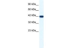 WB Suggested Anti-IBSP Antibody Titration:  1. (IBSP 抗体  (N-Term))