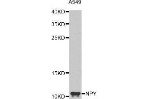 Western blot analysis of extracts of A549 cell line, using NPY antibody. (NPY 抗体  (AA 1-97))