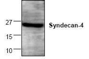 Image no. 1 for anti-Syndecan 4 (SDC4) antibody (ABIN127275) (SDC4 抗体)