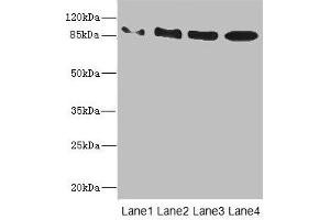 Western blot All lanes: TAS1R3 antibody at 1. (TAS1R3 抗体  (AA 400-570))