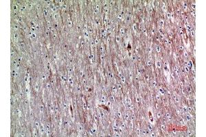 Immunohistochemistry (IHC) image for anti-ADAM Metallopeptidase with thrombospondin Type 1 Motif, 18 (ADAMTS18) antibody (ABIN3188077)