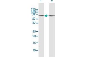 Western Blotting (WB) image for anti-Solute Carrier Family 5 (Sodium/glucose Cotransporter), Member 1 (SLC5A1) (AA 1-664) antibody (ABIN950039)