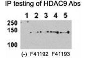 HDAC9 antibody NSJ# F41192 and NSJ# F41193 can both immunoprecipitate the protein from HeLa-HDAC9 tranfected cells. (HDAC9 抗体  (AA 2-32))