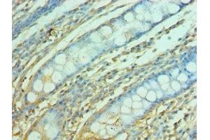 Immunohistochemistry of paraffin-embedded human colon tissue using ABIN7153122 at dilution of 1:100 (FOSL1 抗体  (AA 1-100))