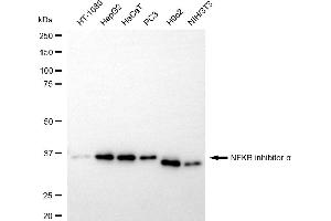 Western blotting analysis using NFKB inhibitor alpha antibody (ABIN7799641).