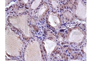 Immunohistochemistry (IHC) image for anti-Solute Carrier Family 5 (Sodium/iodide Cotransporter), Member 5 (SLC5A5) (AA 525-618) antibody (ABIN668751)