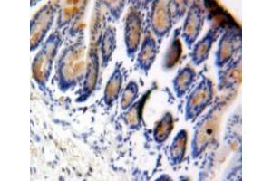Immunohistochemistry (IHC) image for anti-Eukaryotic Translation Initiation Factor 4E Binding Protein 1 (EIF4EBP1) (AA 2-117) antibody (ABIN7436867)