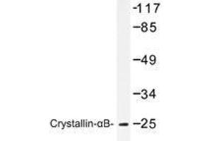 Western blot analysis of Crystallin-αB antibody in extracts from mouse lung cells. (CRYAB 抗体)