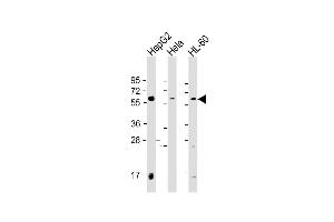 Western Blot at 1:2000 dilution Lane 1: HepG2 whole cell lysate Lane 2: Hela whole cell lysate Lane 3: HL-60 whole cell lysate Lysates/proteins at 20 ug per lane. (PI4K2A 抗体  (C-Term))