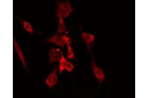 ABIN6275145 staining COLO205 cells by IF/ICC. (GCP6 抗体  (Internal Region))