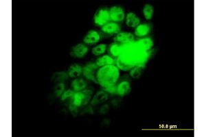 Immunofluorescence of monoclonal antibody to RBM9 on A-431 cell. (RBM9 抗体  (AA 1-100))