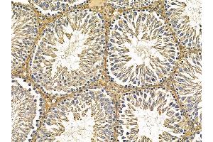 ABIN7095632 and ABIN7099694 at 1/100 staining rat testis tissue by IHC-P. (ETF1 抗体)