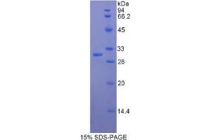 SDS-PAGE analysis of Human Multimerin 1 Protein. (Multimerin 1 Protein (MMRN1))