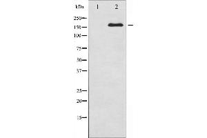 Western blot analysis of IRS-1 expression in NIH-3T3 whole cell lysates,The lane on the left is treated with the antigen-specific peptide.
