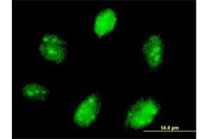 Immunofluorescence of purified MaxPab antibody to ETV7 on Daoy cell. (ETV7 抗体  (AA 1-341))