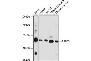 Western blot analysis of extracts of various cell lines using TRIM5 Polyclonal Antibody at dilution of 1:1000. (TRIM5 抗体)