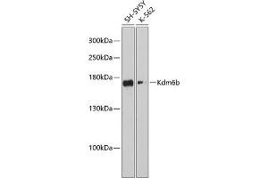 Western blot analysis of extracts of various cell lines, using Kdm6b antibody (ABIN6131823, ABIN6142806, ABIN6142809 and ABIN6216507) at 1:3000 dilution.