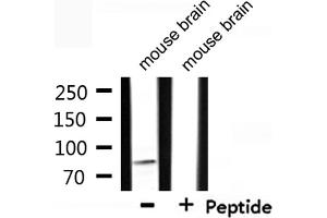 Western blot analysis of extracts from mouse brain, using CDH15 Antibody.