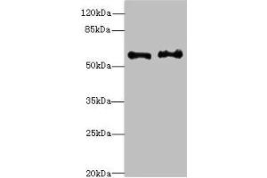 Western blot All lanes: NMT2 antibody at 4. (NMT2 抗体  (AA 1-120))