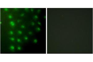 Immunofluorescence analysis of HUVEC cells, using AKAP8 antibody.