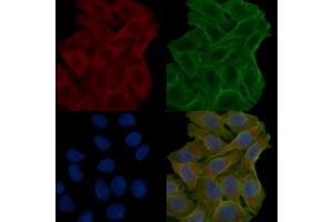 ABIN7094065 and ABIN7098109 staining Hela cells(24h of starvation treatment) by IF/ICC. (AP2B1 抗体  (N-Term))