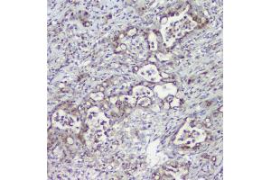 IHC analysis of MPI using anti-MPI antibody (ABIN4886672).
