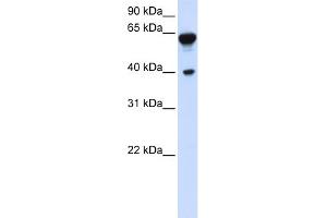 WB Suggested Anti-DTNB Antibody Titration:  0. (Dystrobrevin beta 抗体  (C-Term))