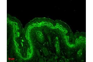 Immunohistochemistry (IHC) image for anti-Mitogen-Activated Protein Kinase 3 (MAPK3) antibody (ABIN361833)