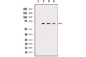 Western blot analysis of extracts from various samples, using ETFDH Antibody.