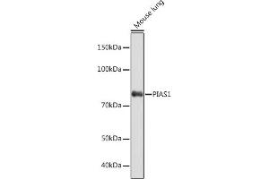 Western blot analysis of extracts of Mouse lung, using PI Rabbit mAb (ABIN7269622) at 1:1000 dilution.