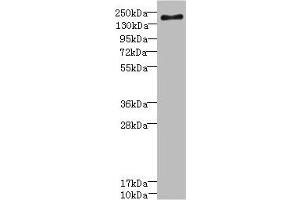 Western blot All lanes: SCN7A antibody at 2. (SCN7A 抗体  (AA 265-368))
