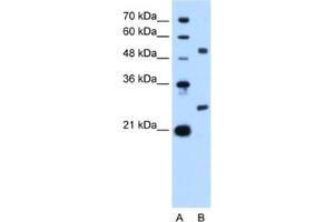 Western Blotting (WB) image for anti-BCL2-Like 1 (BCL2L1) antibody (ABIN2460189) (BCL2L1 抗体)