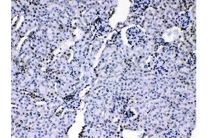HnRNP A1 was detected in paraffin-embedded sections of mouse kidney tissues using rabbit anti- HnRNP A1 Antigen Affinity purified polyclonal antibody (Catalog # ) at 1 µg/mL. (HNRNPA1 抗体  (N-Term))