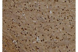 ABIN6279684 at 1/100 staining Rat brain tissue by IHC-P. (PRDM10 抗体  (C-Term))