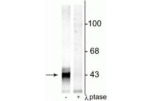 Western blot of rat hippocampal lysate showing specific immunolabeling of the ~43 kDa connexin43 phosphorylated at Ser368 in the first lane (-). (Connexin 43/GJA1 抗体  (pSer368))