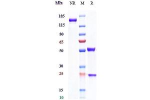 Anti-IL-2Ra / CD25 Reference Antibody (daclizumab) on SDS-PAGE under reducing (R) condition. (Recombinant IL2RA (Daclizumab Biosimilar) 抗体)